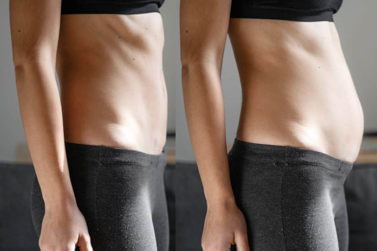 How long does diastasis recti take to improve Colchester?