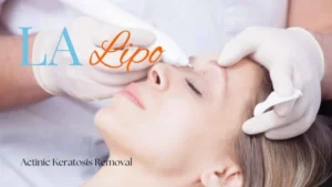 Woman receiving Actinic Keratosis Removal Treatment Colchester