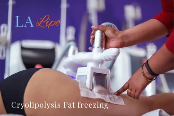 women getting fat freezing Colchester