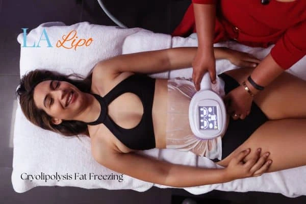 woman getting cryolipolysis Colchester