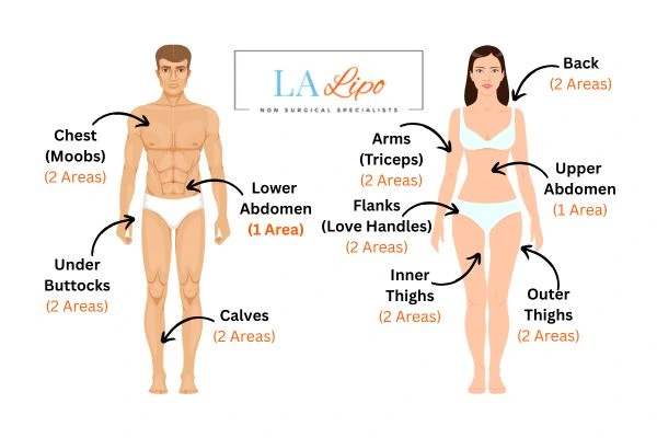 LA LIPO Cryolipolysis Areas Colchester